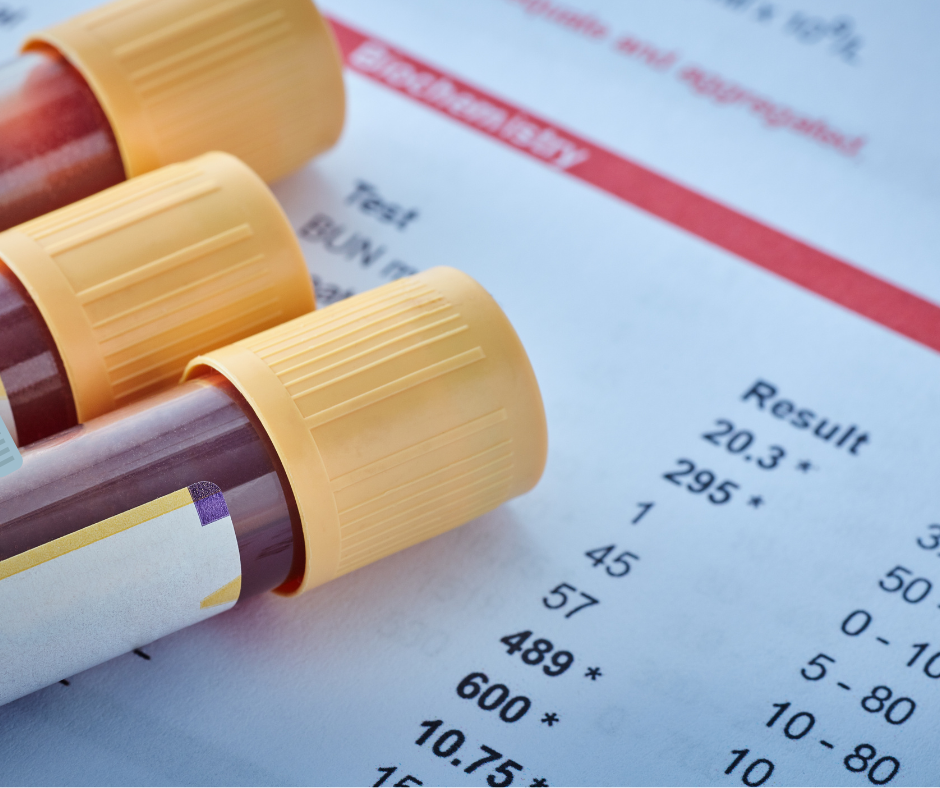 Three capped blood sample tubes resting on a printed biochemistry results sheet