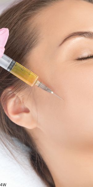 A practitioner injecting platelet-rich plasma into a client’s temple